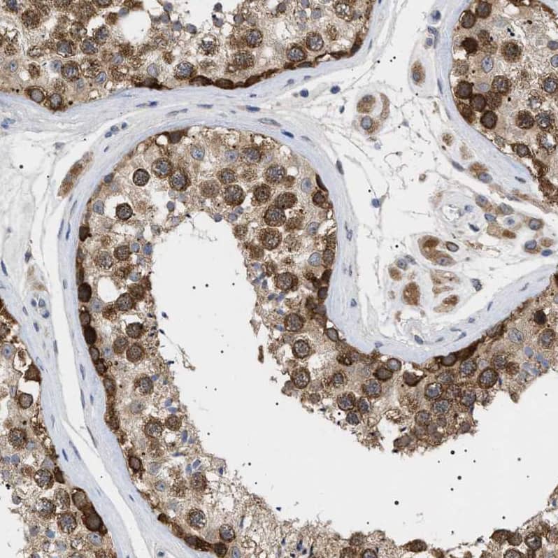 Staining of human testis shows weak to moderate positivity in nuclear membrane in cells in seminiferous ducts.