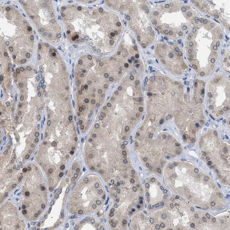 Staining of human kidney shows weak to moderate positivity in nuclear membrane in cells in tubules.
