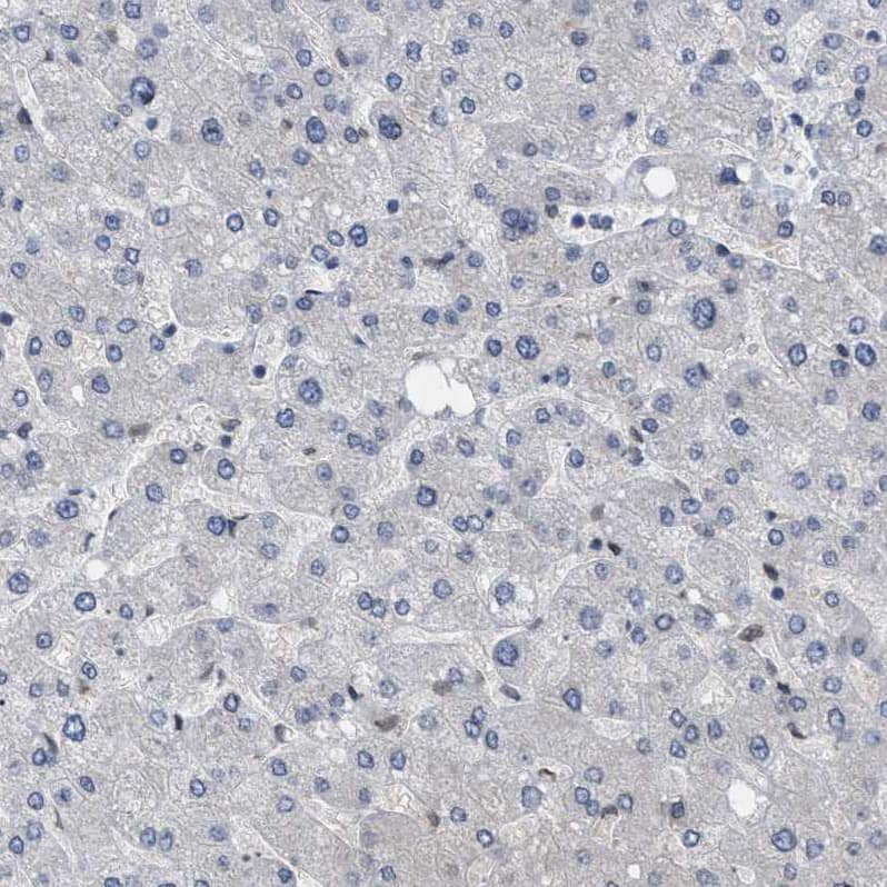 Staining of human liver shows no positivity in hepatocytes as expected.