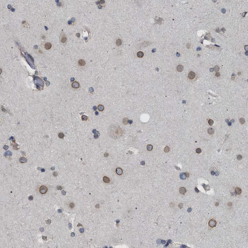 Staining of human cerebral cortex shows moderate positivity in nuclear membrane in neurons.