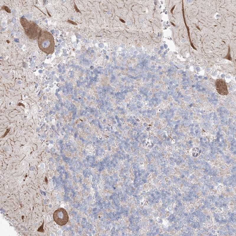 Staining of human cerebellum shows moderate cytoplasmic positivity in Purkinje cells.