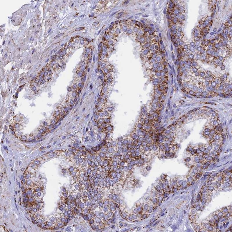 Staining of human prostate shows moderate membranous-cytoplasmic positivity in glandular cells.