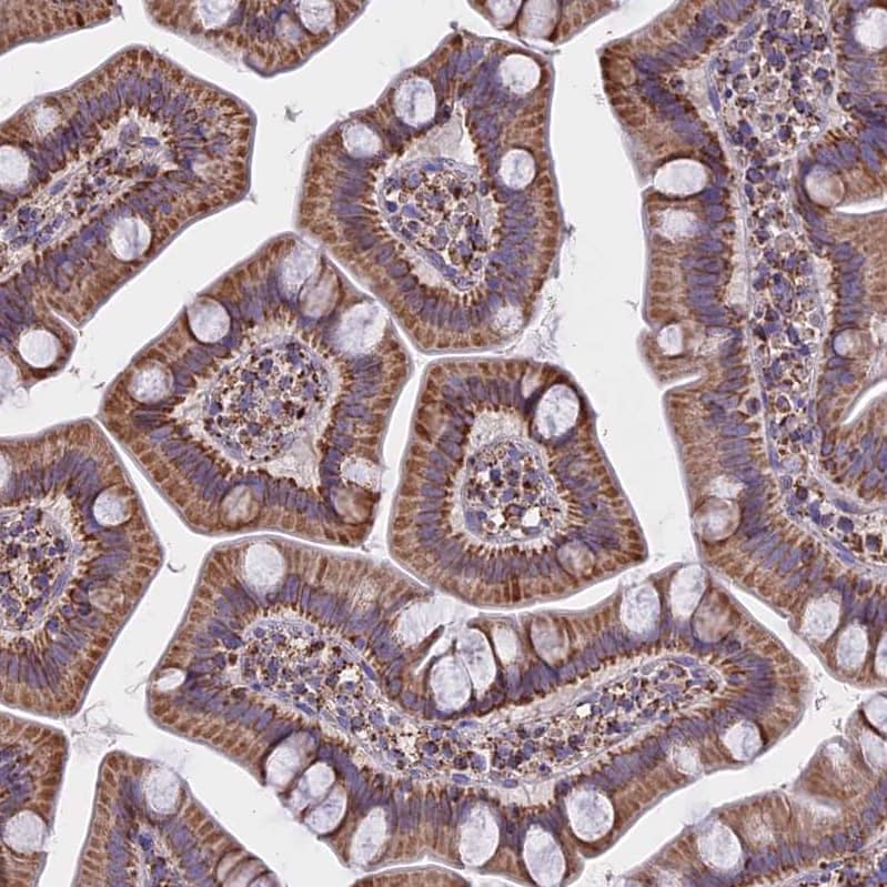 Staining of human gastrointestinal shows moderate membranous-cytoplasmic positivity in glandular cells.