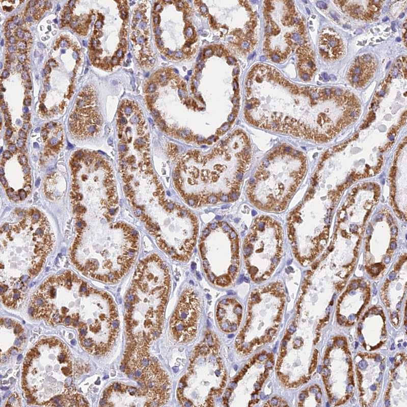 Staining of human kidney shows moderate membranous-cytoplasmic positivity in cells in tubules.