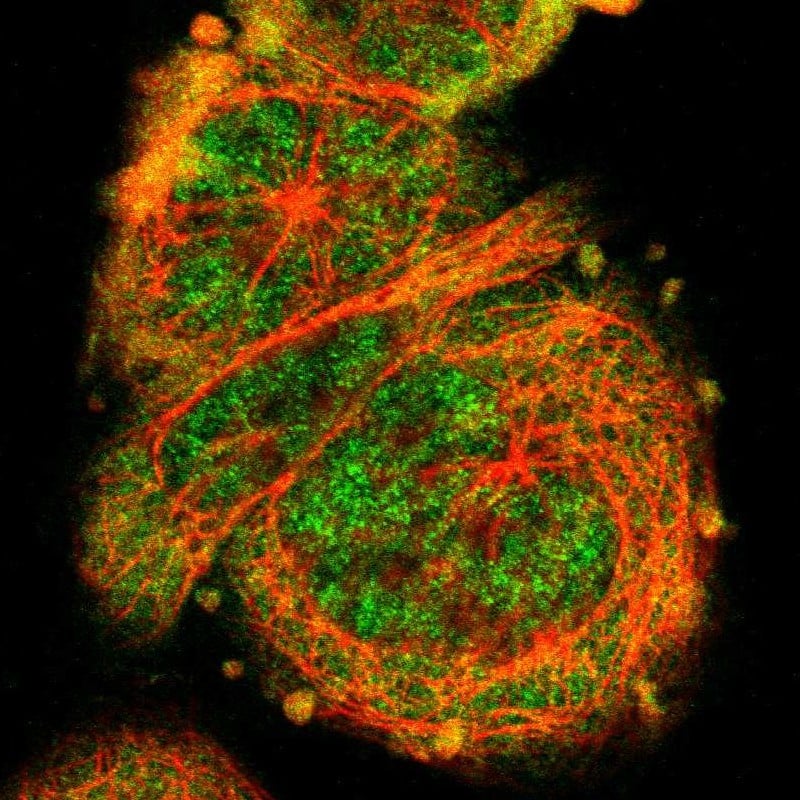 Staining of human cell line A-431 shows localization to nucleoplasm & cytosol.