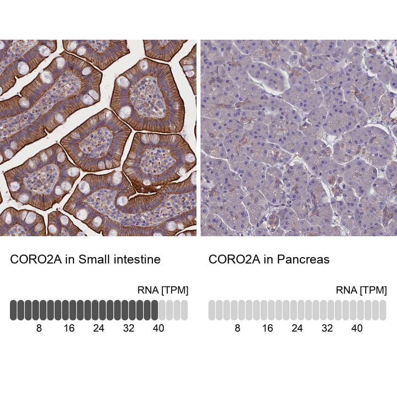 Immunohistochemistry-Paraffin CORO2A Antibody - BSA Free