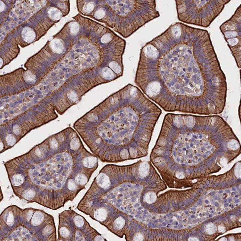 Immunohistochemistry-Paraffin CORO2A Antibody - BSA Free