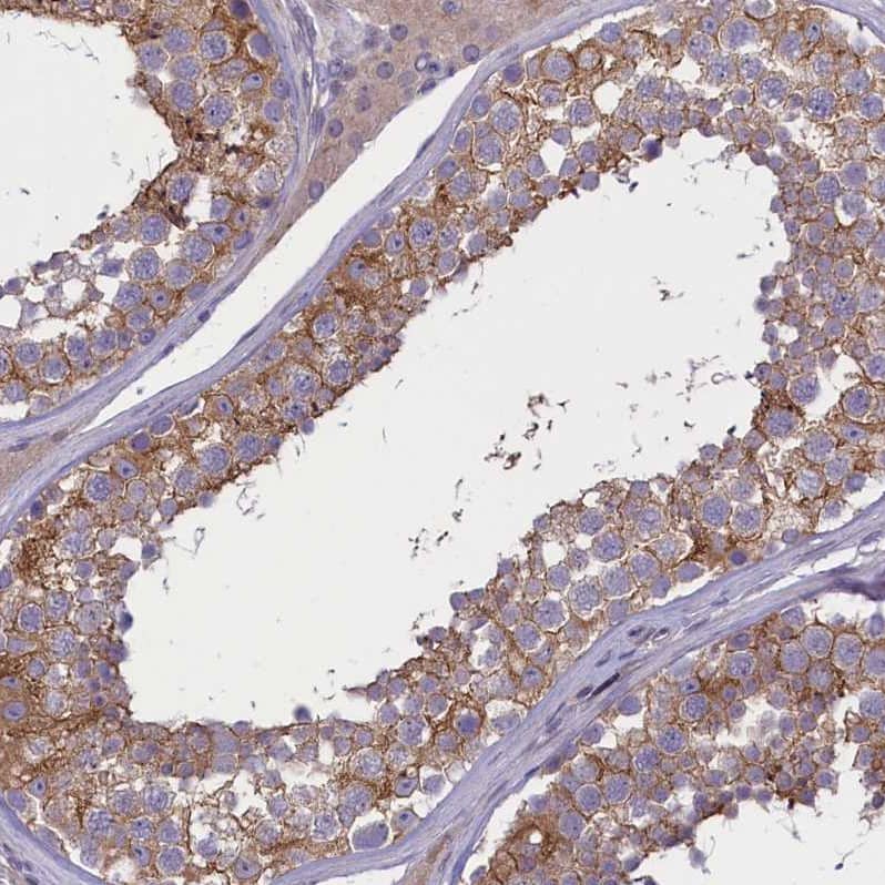 Immunohistochemistry-Paraffin CORO2A Antibody - BSA Free
