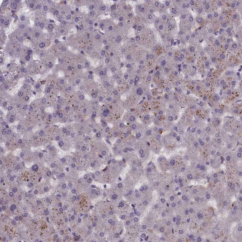Immunohistochemistry-Paraffin CORO2A Antibody - BSA Free