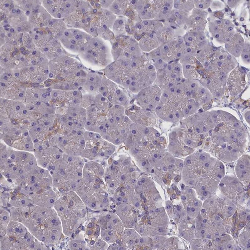Immunohistochemistry-Paraffin CORO2A Antibody - BSA Free