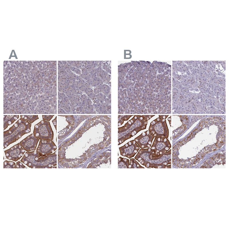 Immunohistochemistry-Paraffin CORO2A Antibody - BSA Free