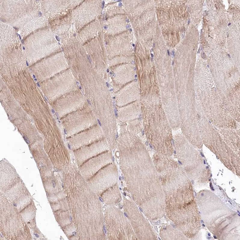 Immunohistochemistry-Paraffin TNPO3 Antibody - BSA Free