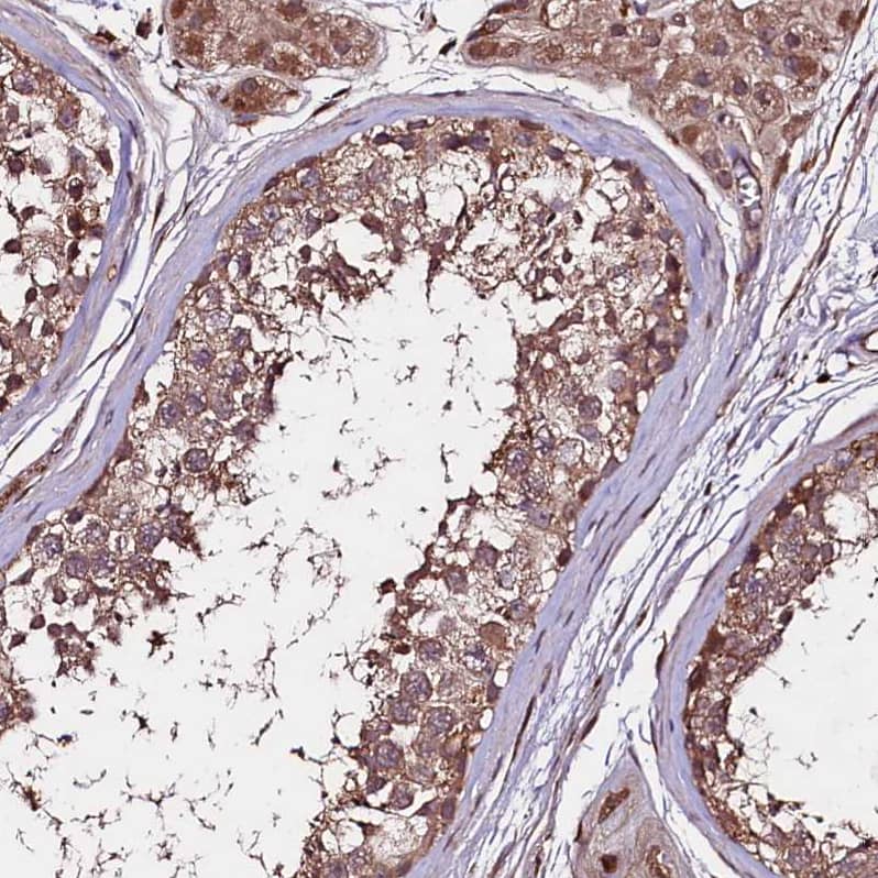 Immunohistochemistry-Paraffin TNPO3 Antibody - BSA Free