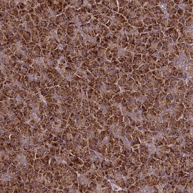 Immunohistochemistry-Paraffin TNPO3 Antibody - BSA Free