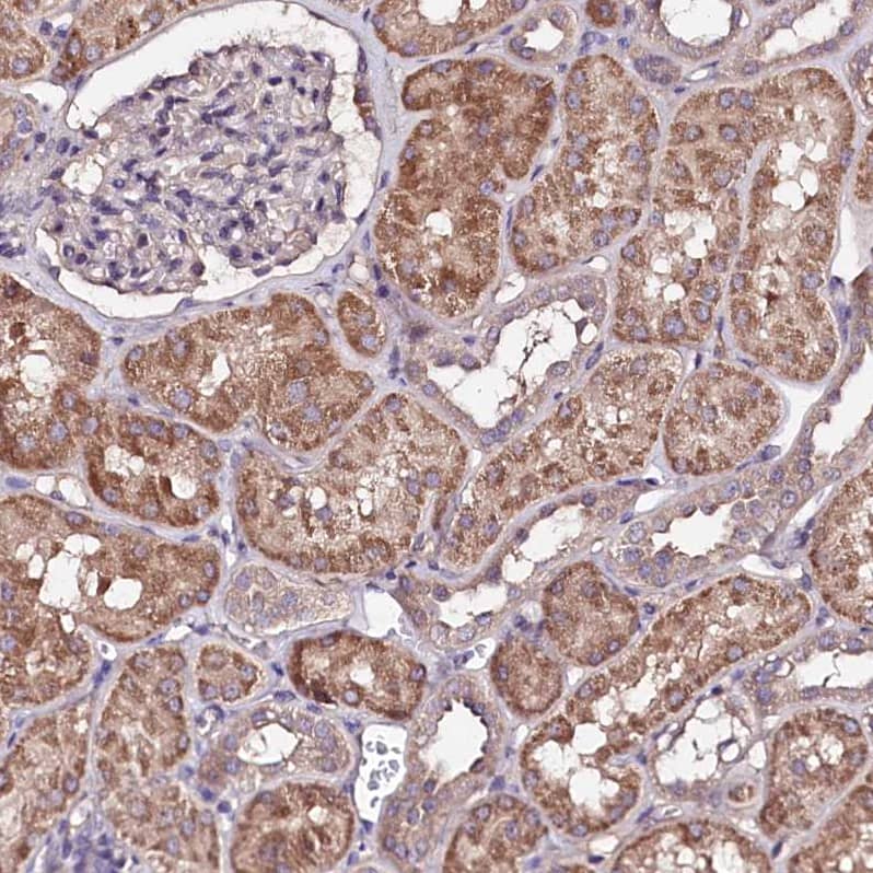 Immunohistochemistry-Paraffin TNPO3 Antibody - BSA Free