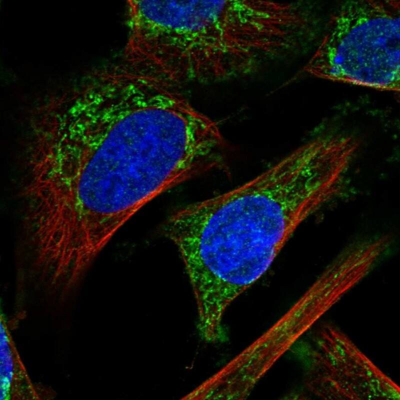 Staining of human cell line U-251 MG shows localization to mitochondria.