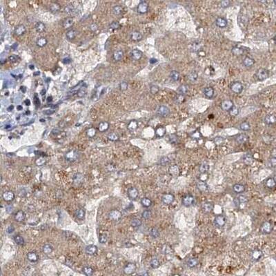 Staining of human liver.
