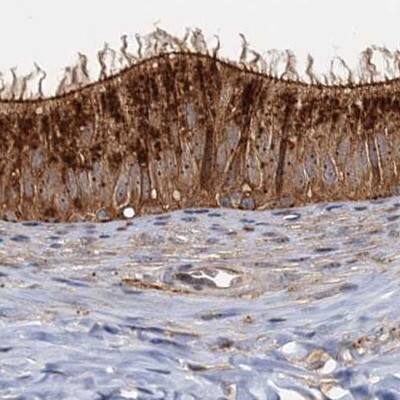 Staining of human epididymis.