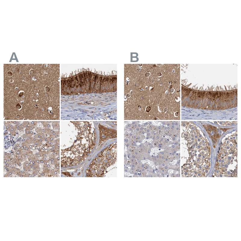 Staining of human cerebral cortex, epididymis, liver and testis HPA038621 (A) shows similar protein distribution across tissues to independent antibody HPA038622 (B).