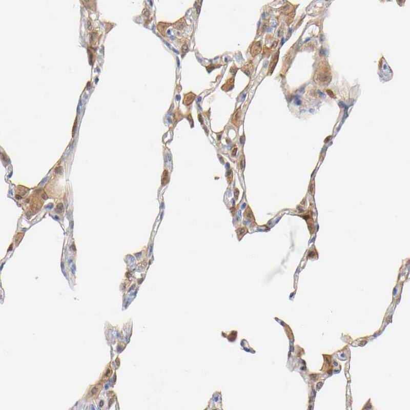 Staining of human lung shows moderate cytoplasmic positivity in macrophages.