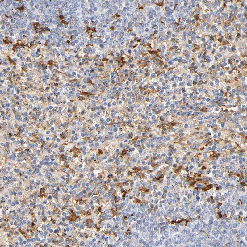 <b>Orthogonal Strategies Validation. </b>Staining of human spleen shows moderate cytoplasmic positivity.