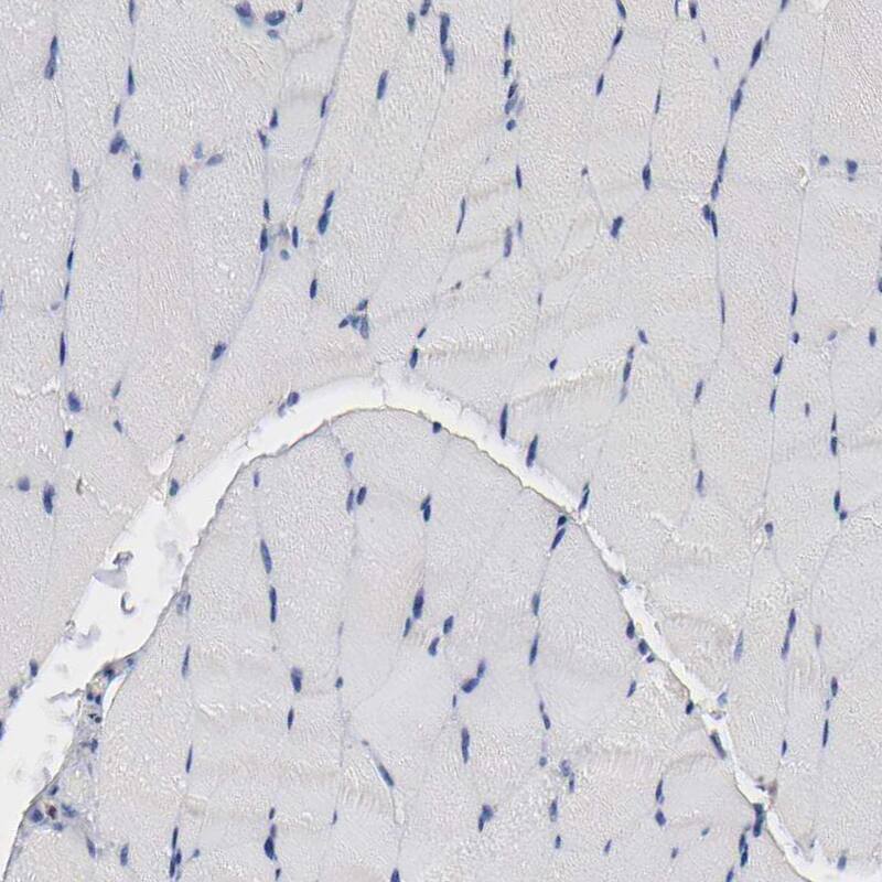 Staining of human skeletal muscle shows no positivity in myocytes as expected.