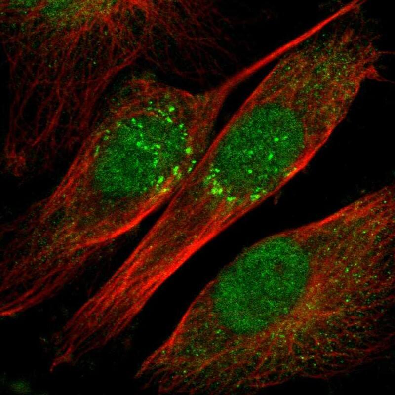 Staining of human cell line U-251 MG shows localization to nucleus & the Golgi apparatus.