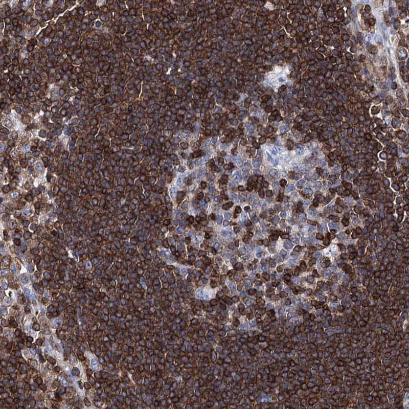 Staining of human lymph node shows high expression.