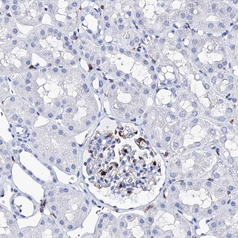 Staining of human kidney shows low expression as expected.