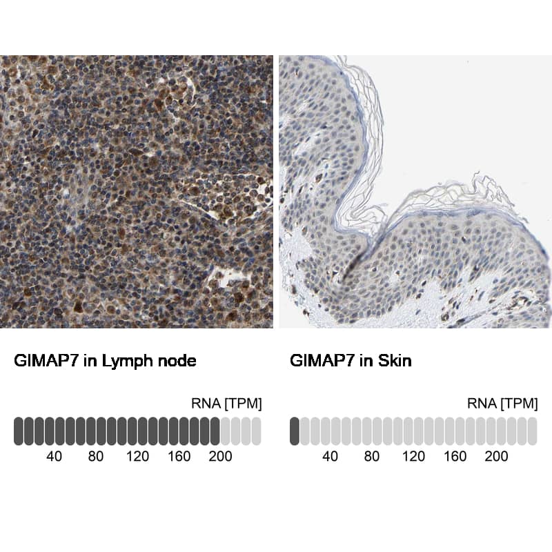 Immunohistochemistry-Paraffin GIMAP7 Antibody - BSA Free