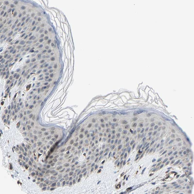 Immunohistochemistry-Paraffin GIMAP7 Antibody - BSA Free