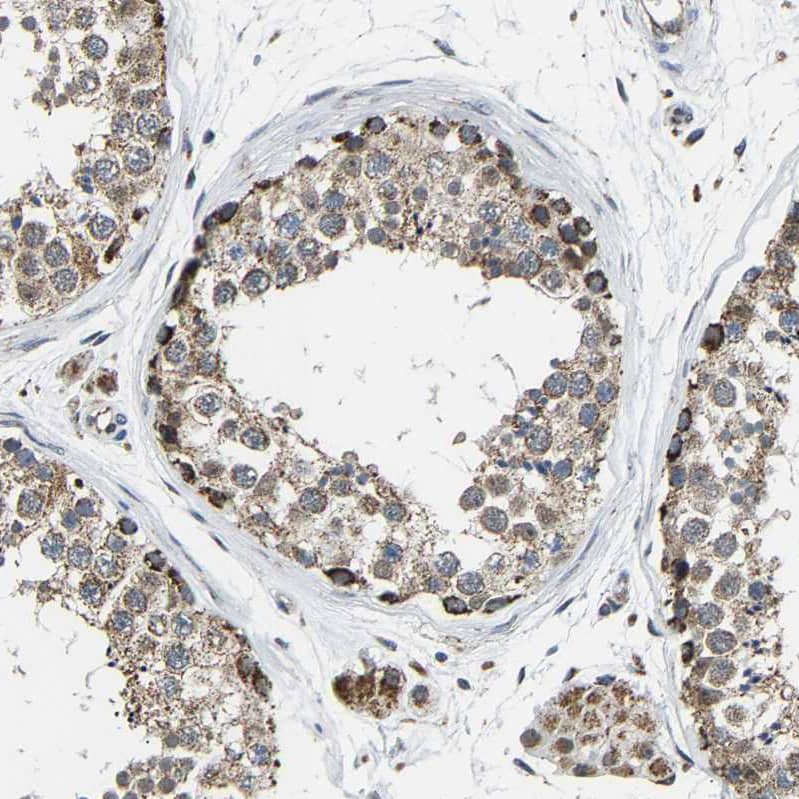 Immunohistochemistry-Paraffin GIMAP7 Antibody - BSA Free