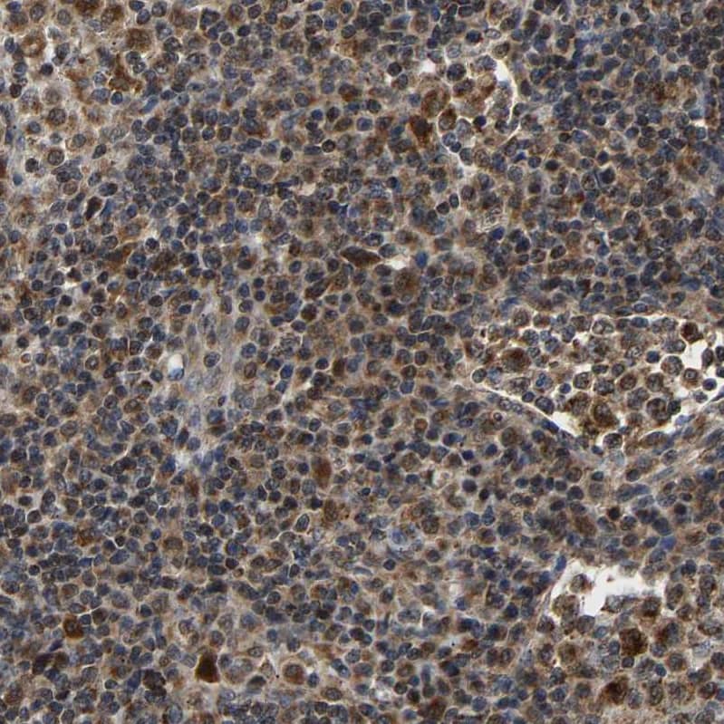 Immunohistochemistry-Paraffin GIMAP7 Antibody - BSA Free