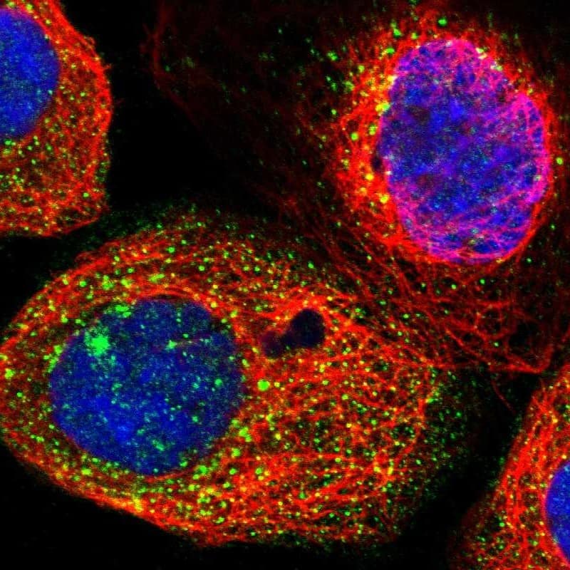 Staining of human cell line A-431 shows localization to vesicles.