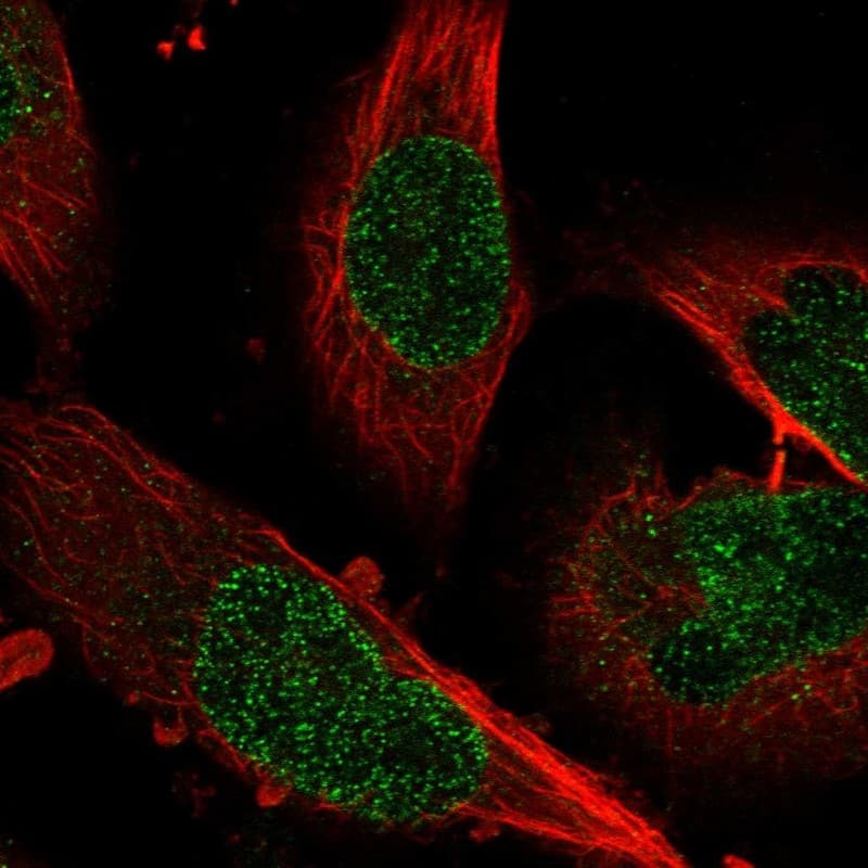 Immunocytochemistry/ Immunofluorescence ZNF124 Antibody - BSA Free