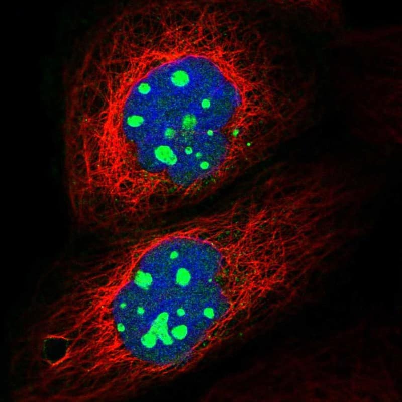 Staining of human cell line A-431 shows localization to nucleoli.