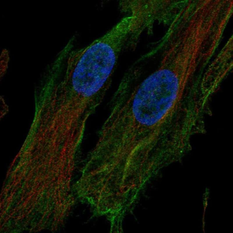 Staining of human cell line LHCN-M2 shows localization to plasma membrane.