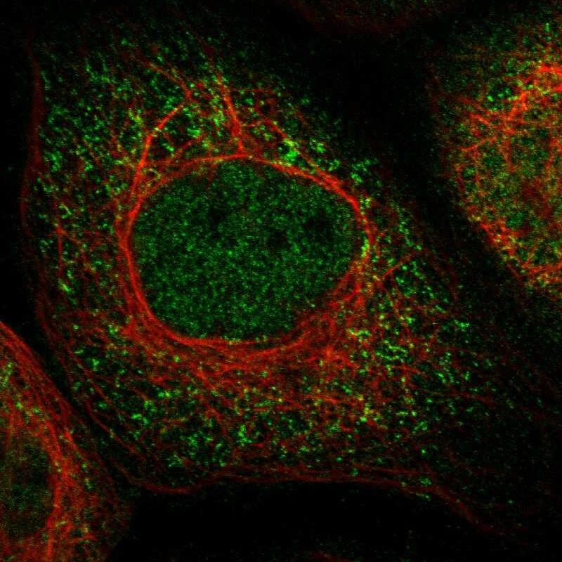 Staining of human cell line A-431 shows localization to nucleoplasm & cytosol.