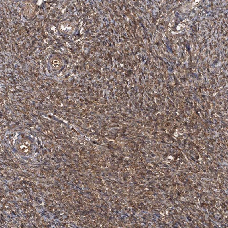 Staining of human ovary shows cytoplasmic positivity in ovarian stroma cells.
