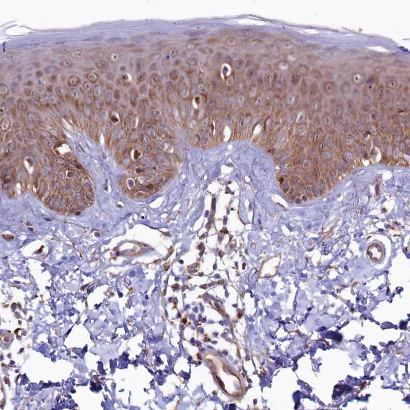 Staining of human skin shows strong cytoplasmic positivity in squamous epithelial cells.
