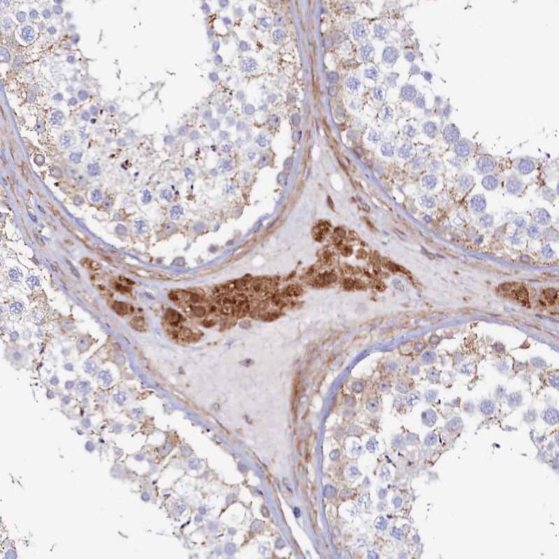 Staining of human testis shows strong cytoplasmic positivity in Leydig cells.