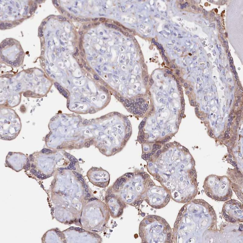 Staining of human placenta shows weak cytoplasmic positivity in trophoblastic cells.