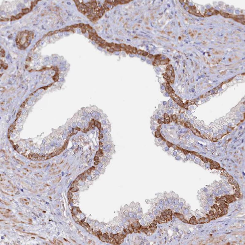 Staining of human prostate shows strong cytoplasmic positivity in basal cells.