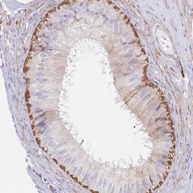 Staining of human epididymis shows strong cytoplasmic positivity in basal cells.