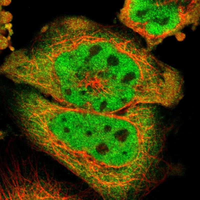 Immunocytochemistry/ Immunofluorescence MEIS2 Antibody - BSA Free