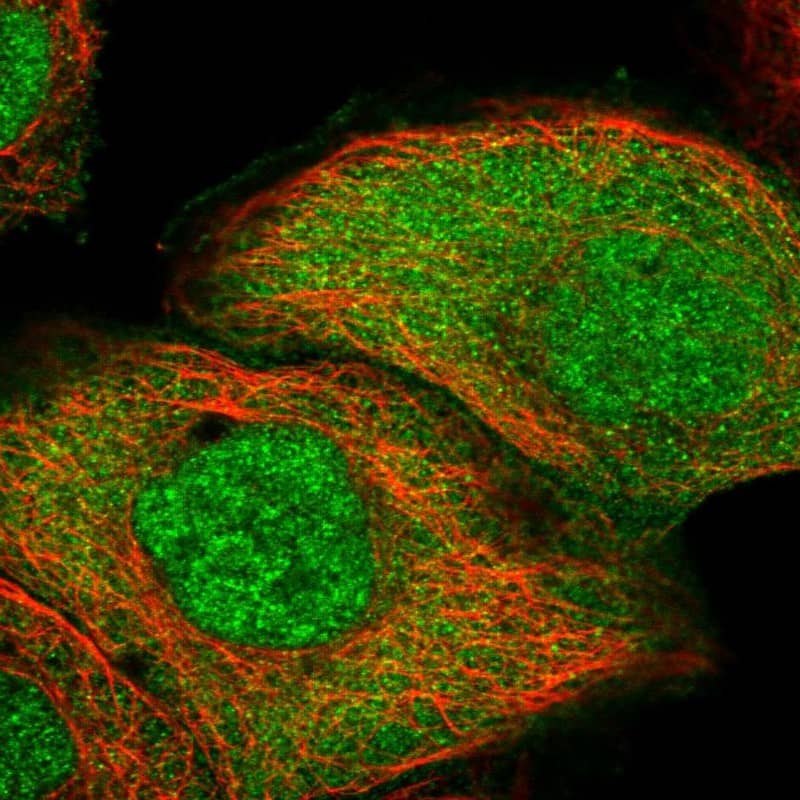 Staining of human cell line A-431 shows localization to nucleoplasm & cytosol.