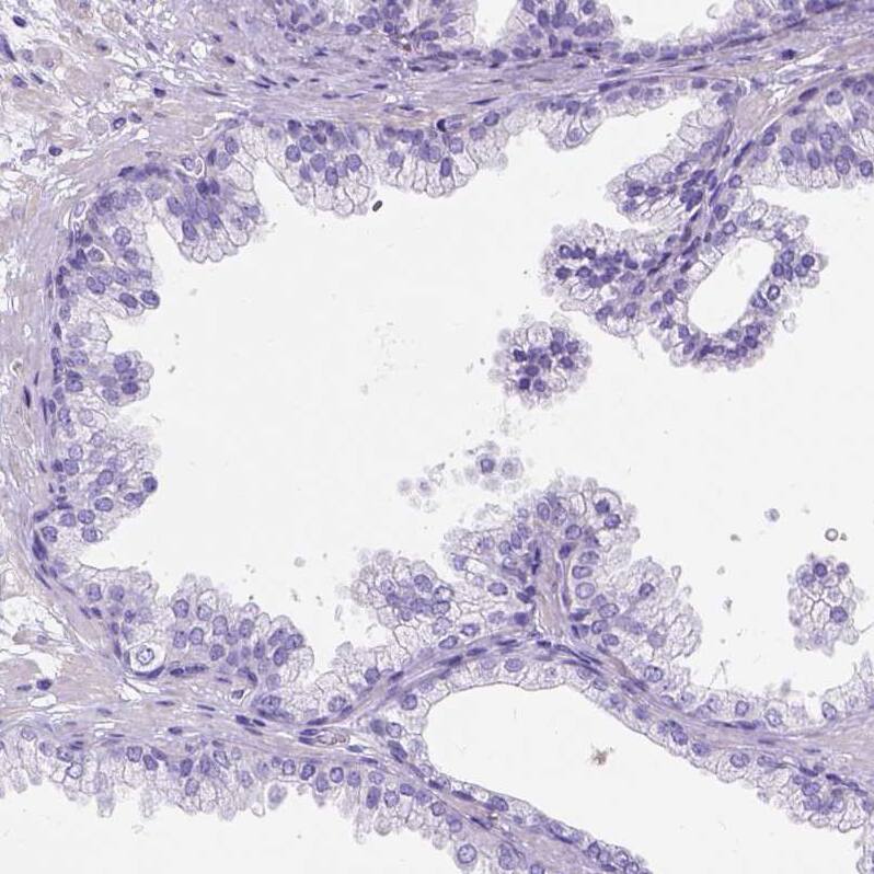 Staining of human prostate shows no positivity in glandular cells as expected.