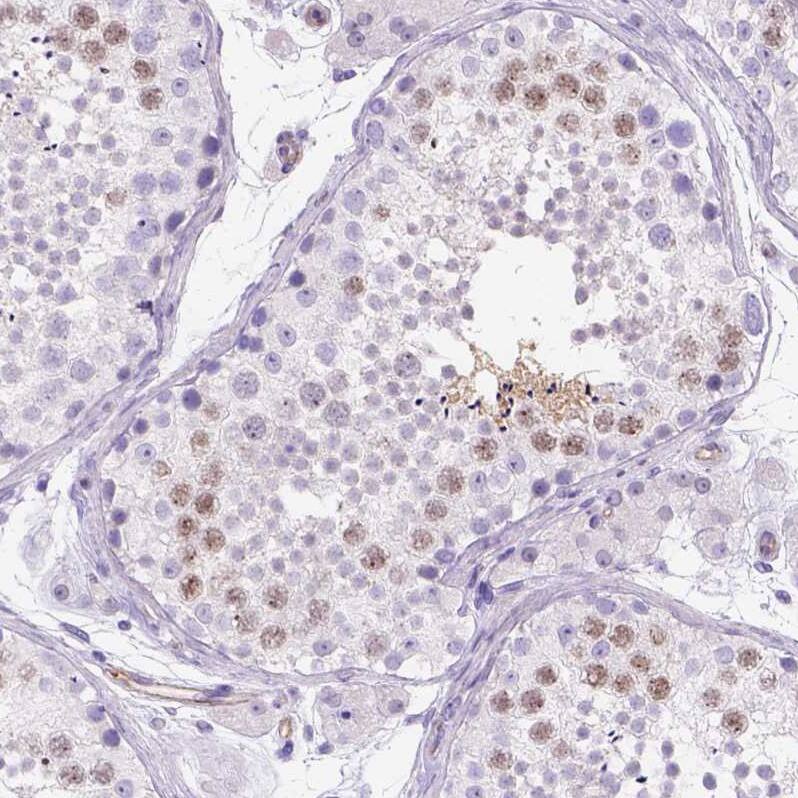Staining of human testis shows moderate nuclear positivity.