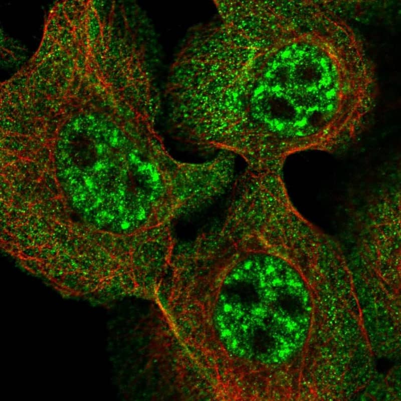Staining of human cell line A-431 shows localization to nuclear speckles & cytosol.
