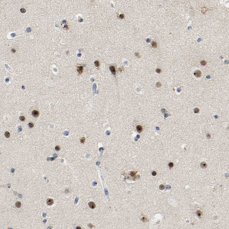 Immunohistochemistry-Paraffin NOP58 Antibody - BSA Free